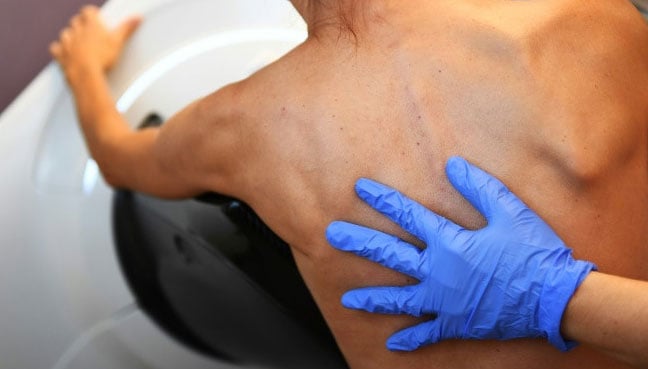Doctors Want to Implant Color-changing Mole Tattoo to Detect Skin Cancer