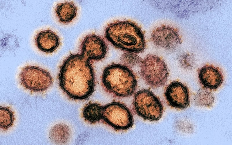 Coronavirus Can Remain Infectious in Air for Hours